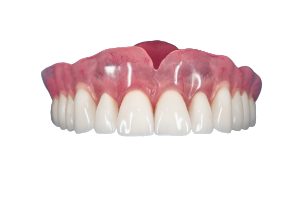 A Complete Guide to Acrylic Dentures: What You Need to Know